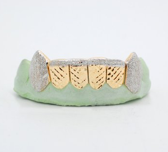 6 Teeth Custom Yellow Gold Diamond Cut W/Diamond Dust Fangz & Top Bar