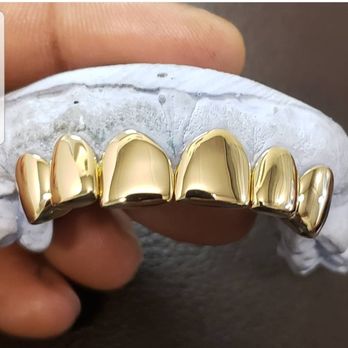 6 Solid Gold Top/Bottom Grillz