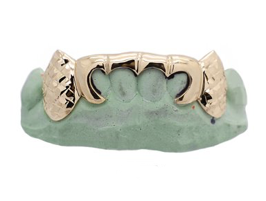 Custom 6 Teeth Yellow Gold Open Face W/Diamond Cut Fangz