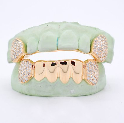 Custom 8 Teeth Yellow Gold W/Diamond Fangz Top & Bottom Grillz