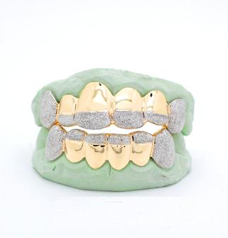 12 Teeth Yellow Gold W/Diamond Dust