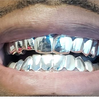 16 Teeth Top & Bottom Solid White Gold Grillz